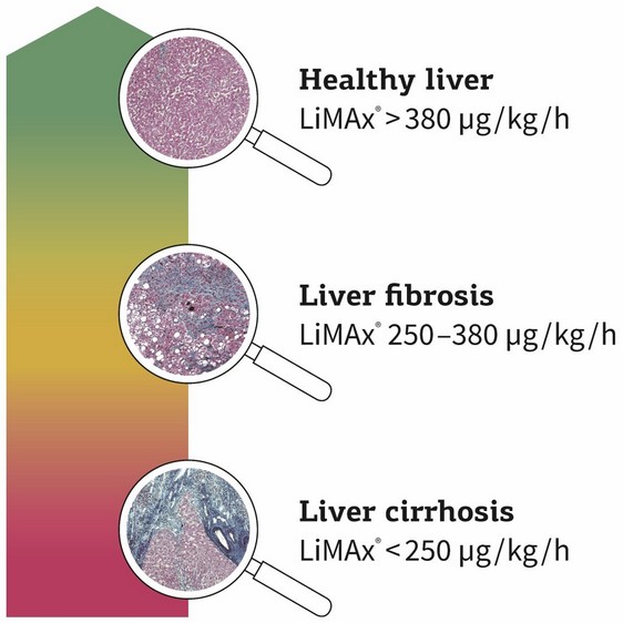 Medizinische Hochschule Hannover : Liver function test LIMAX